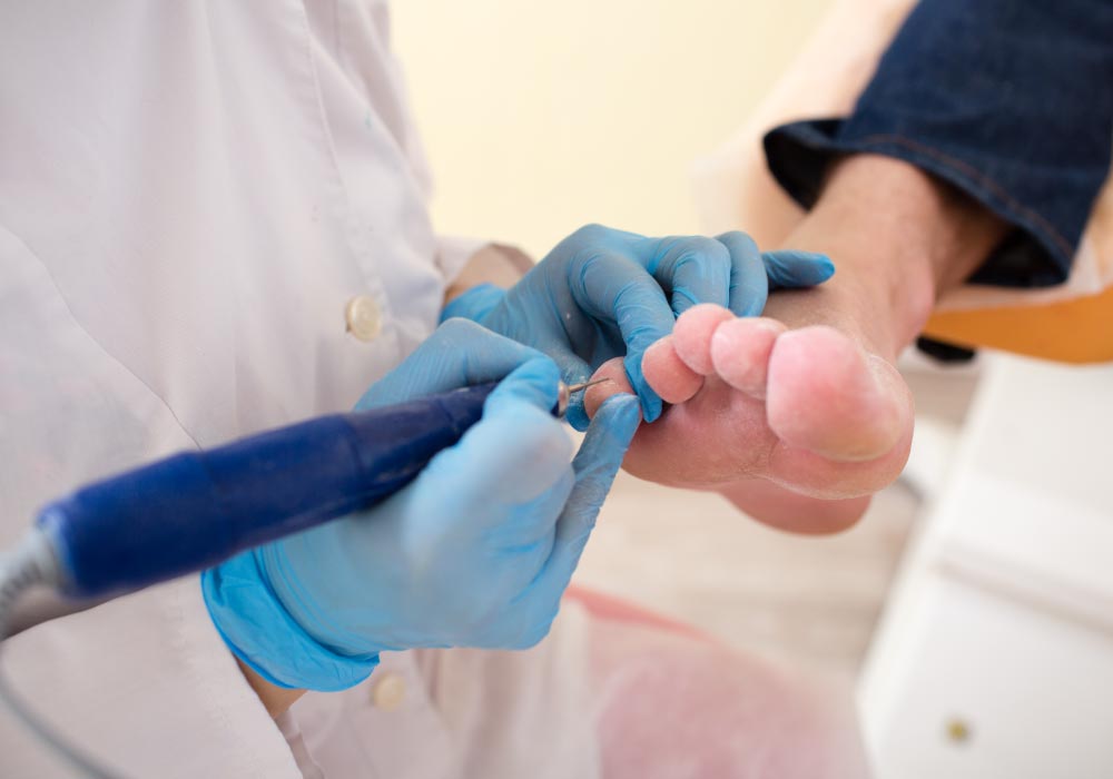 reconstruccion de uñas